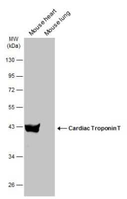 Western Blot: Cardiac Troponin T Antibody [NBP3-13391]