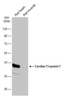 Western Blot: Cardiac Troponin T Antibody [NBP3-13391]