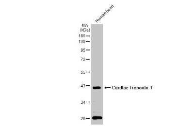 Western Blot: Cardiac Troponin T Antibody [NBP3-13391]
