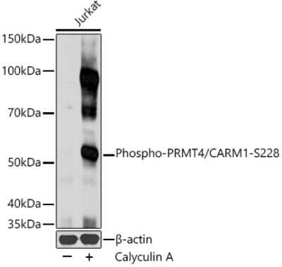 Western Blot: Carm1 [p Ser228] AntibodyAzide and BSA Free [NBP3-16892]