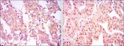 Immunohistochemistry: Carm1 Antibody (3H2) - BSA Free [NBP2-37645]