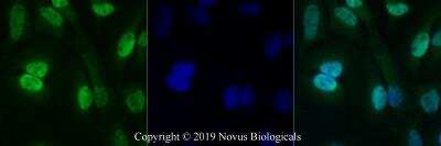 Immunocytochemistry/ Immunofluorescence: Carm1 Antibody [NB100-56374]
