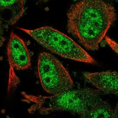 Immunocytochemistry/ Immunofluorescence: Carm1 Antibody [NBP2-55993]