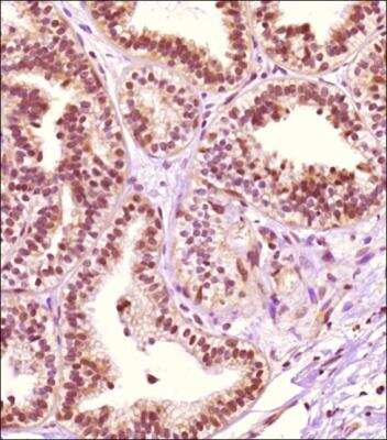 Immunohistochemistry-Paraffin: Carm1 Antibody [NB100-56374]