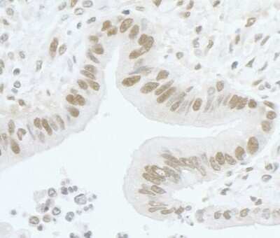 Immunohistochemistry-Paraffin: Carm1 Antibody [NB200-342]