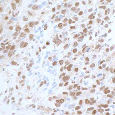Immunohistochemistry-Paraffin: Carm1 Antibody [NB200-342]
