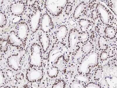 Immunohistochemistry-Paraffin: Carm1 Antibody [NBP2-98754]
