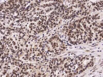 Immunohistochemistry-Paraffin: Carm1 Antibody [NBP2-98754]