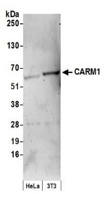 Western Blot: Carm1 Antibody [NB200-341]