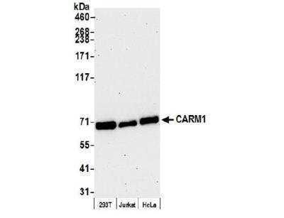 Western Blot: Carm1 Antibody [NB200-342]