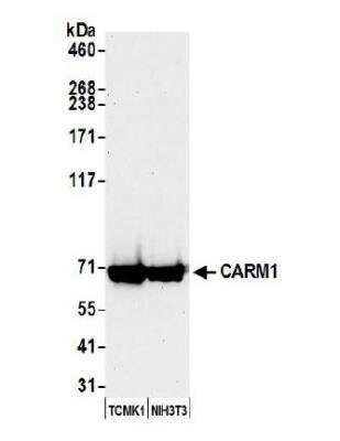 Western Blot: Carm1 Antibody [NB200-342]