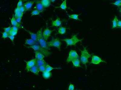 Immunocytochemistry/ Immunofluorescence: Carnosine Dipeptidase 1/CNDP1 Antibody (001) [NBP2-89263]