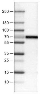 Western Blot: Carnosine Dipeptidase 1/CNDP1 Antibody (CL0339) [NBP2-30972]