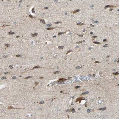 Immunohistochemistry-Paraffin: Carnosine Dipeptidase 1/CNDP1 Antibody [NBP1-85528]