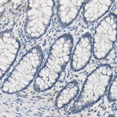 Immunohistochemistry-Paraffin: Carnosine Dipeptidase 1/CNDP1 Antibody [NBP1-85528]