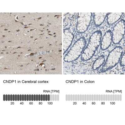 Immunohistochemistry-Paraffin: Carnosine Dipeptidase 1/CNDP1 Antibody [NBP1-85528]