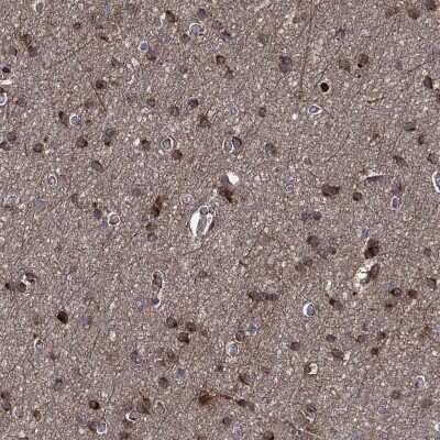 Immunohistochemistry-Paraffin: Carnosine Dipeptidase 1/CNDP1 Antibody [NBP3-17005]