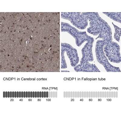 Immunohistochemistry-Paraffin: Carnosine Dipeptidase 1/CNDP1 Antibody [NBP3-17005]