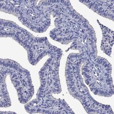 Immunohistochemistry-Paraffin: Carnosine Dipeptidase 1/CNDP1 Antibody [NBP3-17005]