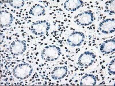 Immunohistochemistry-Paraffin: Carnosine Dipeptidase 1/CNDP1 Antibody (OTI2F8) [NBP1-47702]