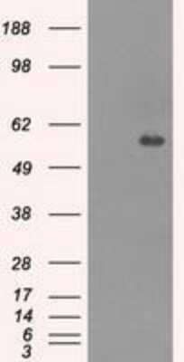 Western Blot: Carnosine Dipeptidase 1/CNDP1 Antibody (OTI2F8) [NBP1-47702]