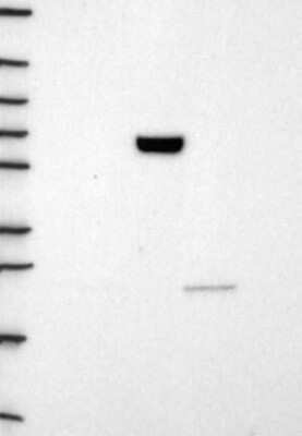 Western Blot: Carnosine Dipeptidase 1/CNDP1 Antibody [NBP3-17005]