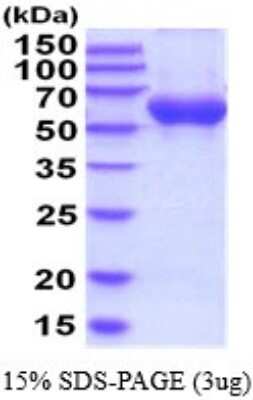 SDS-PAGE: Recombinant Human Carnosine Dipeptidase 1/CNDP1 His Protein [NBP2-52227]