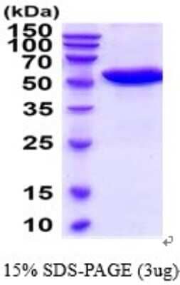 SDS-PAGE: Recombinant Mouse Carnosine Dipeptidase 1/CNDP1 His Protein [NBP2-52380]