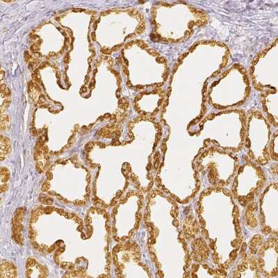 Immunohistochemistry-Paraffin: Casein Antibody [NBP1-91150]