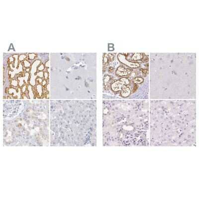 Immunohistochemistry-Paraffin: Casein Antibody [NBP1-91150]