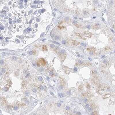 Immunohistochemistry-Paraffin: Casein Antibody [NBP1-91150]
