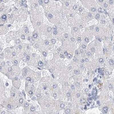 Immunohistochemistry-Paraffin: Casein Antibody [NBP1-91150]