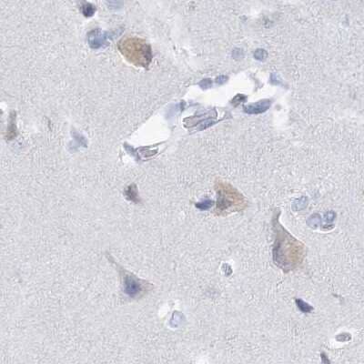 Immunohistochemistry-Paraffin: Casein Antibody [NBP1-91150]