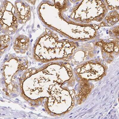 Immunohistochemistry-Paraffin: Casein Antibody [NBP2-55090]