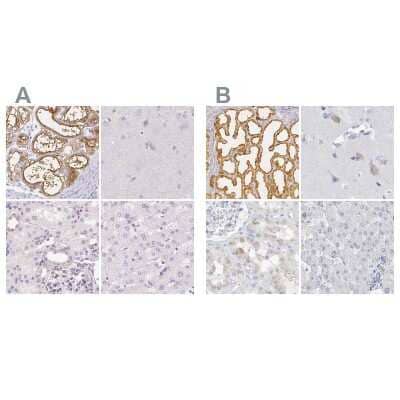 Immunohistochemistry-Paraffin: Casein Antibody [NBP2-55090]