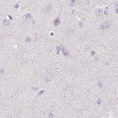 Immunohistochemistry-Paraffin: Casein Antibody [NBP2-55090]
