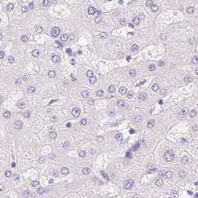 Immunohistochemistry-Paraffin: Casein Antibody [NBP2-55090]