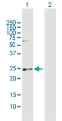 Western Blot: Casein Antibody [H00001446-B01P]