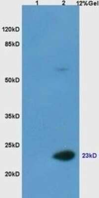 Western Blot: Casein Antibody [NBP3-13485]