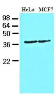 Western Blot: Casein Kinase 1 alpha Antibody (2E2)BSA Free [NBP1-30165]