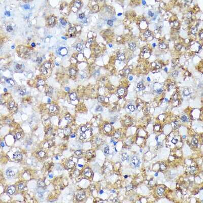 Immunohistochemistry-Paraffin: Casein Kinase 1 alpha Antibody (9O4L9) [NBP3-16807]