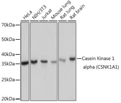 Western Blot: Casein Kinase 1 alpha Antibody (9O4L9) [NBP3-16807]