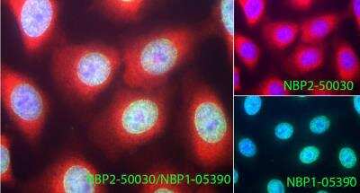 Immunocytochemistry/ Immunofluorescence: Casein Kinase 1 alpha Antibody [NBP2-50030]