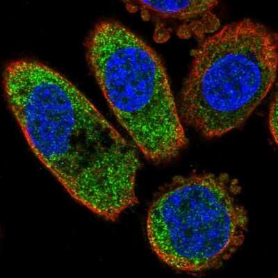 Immunocytochemistry/ Immunofluorescence: Casein Kinase 1 alpha Antibody [NBP2-57137]