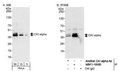 Western Blot: Casein Kinase 1 alpha Antibody [NBP1-18880]