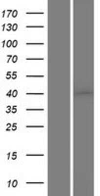 Western Blot: Casein Kinase 1 alpha Overexpression Lysate [NBP2-11032]