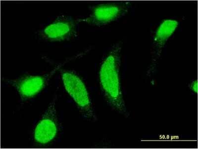 Immunocytochemistry/ Immunofluorescence: Casein Kinase 1 delta Antibody (4H8) [H00001453-M09]