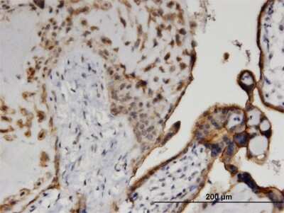 Immunohistochemistry-Paraffin: Casein Kinase 1 delta Antibody (4H8) [H00001453-M09]