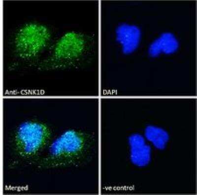 Immunocytochemistry/ Immunofluorescence: Casein Kinase 1 delta Antibody [NB100-2919]