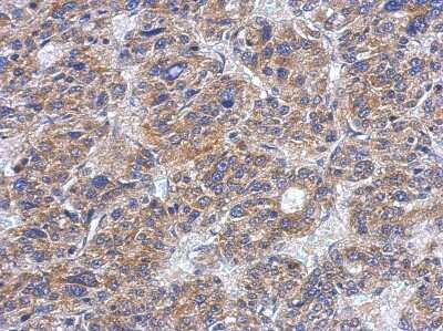 Immunohistochemistry-Paraffin: Casein Kinase 1 delta Antibody [NBP2-15708]